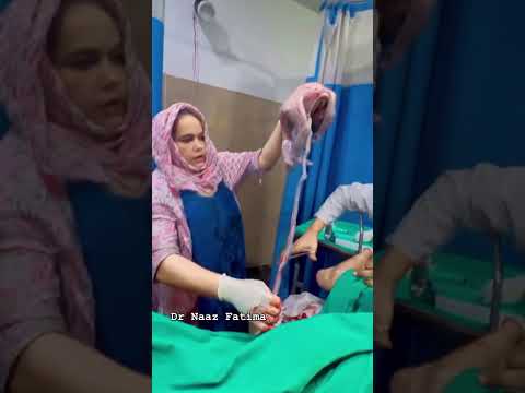 कितना लम्बा नाड़ा ( umbelical cord) है #drnaazfatima #funny #youtubeshorts #