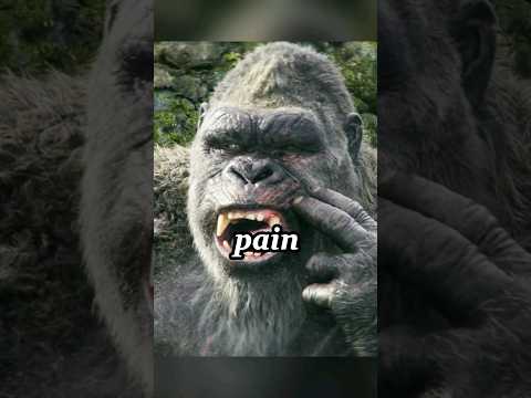 Treating Cavity For King Kong.#movie #funny