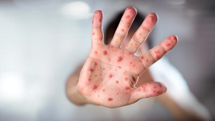 Policy Recommendations for Ensuring Safe and ⁤Informed Immunization Practices