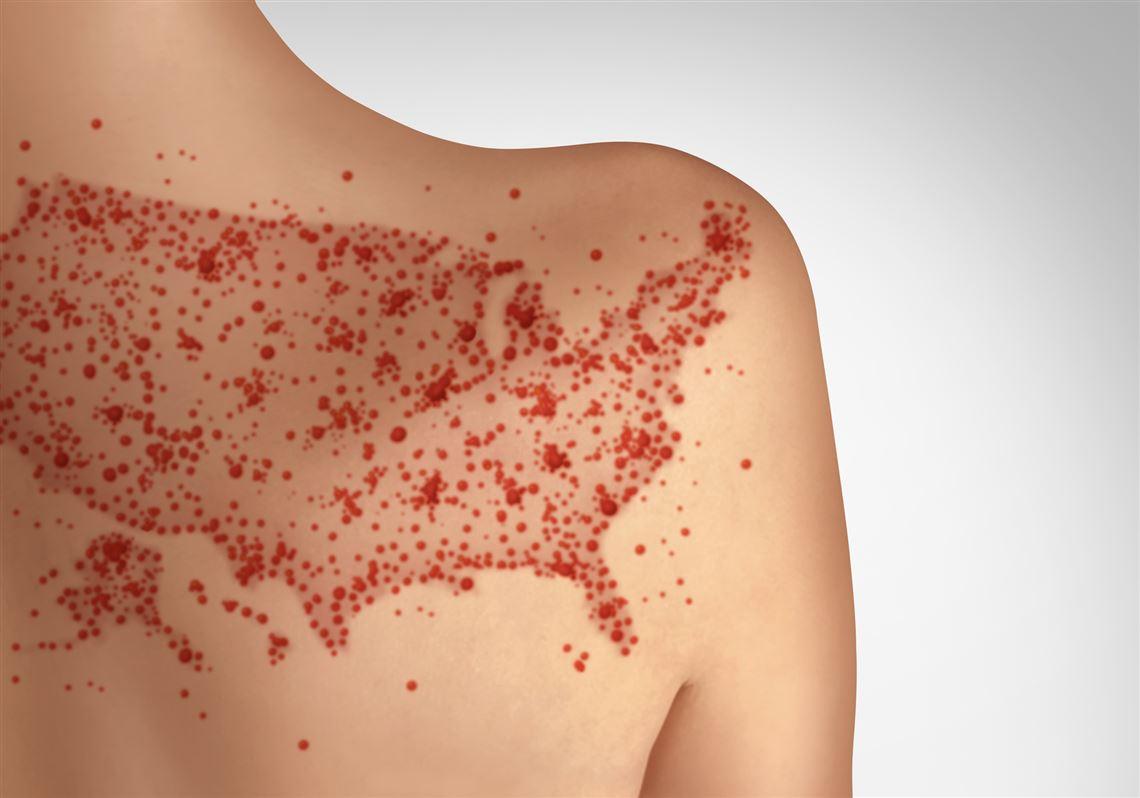 Balancing public Health and Personal Freedoms in Vaccine Policy Debates