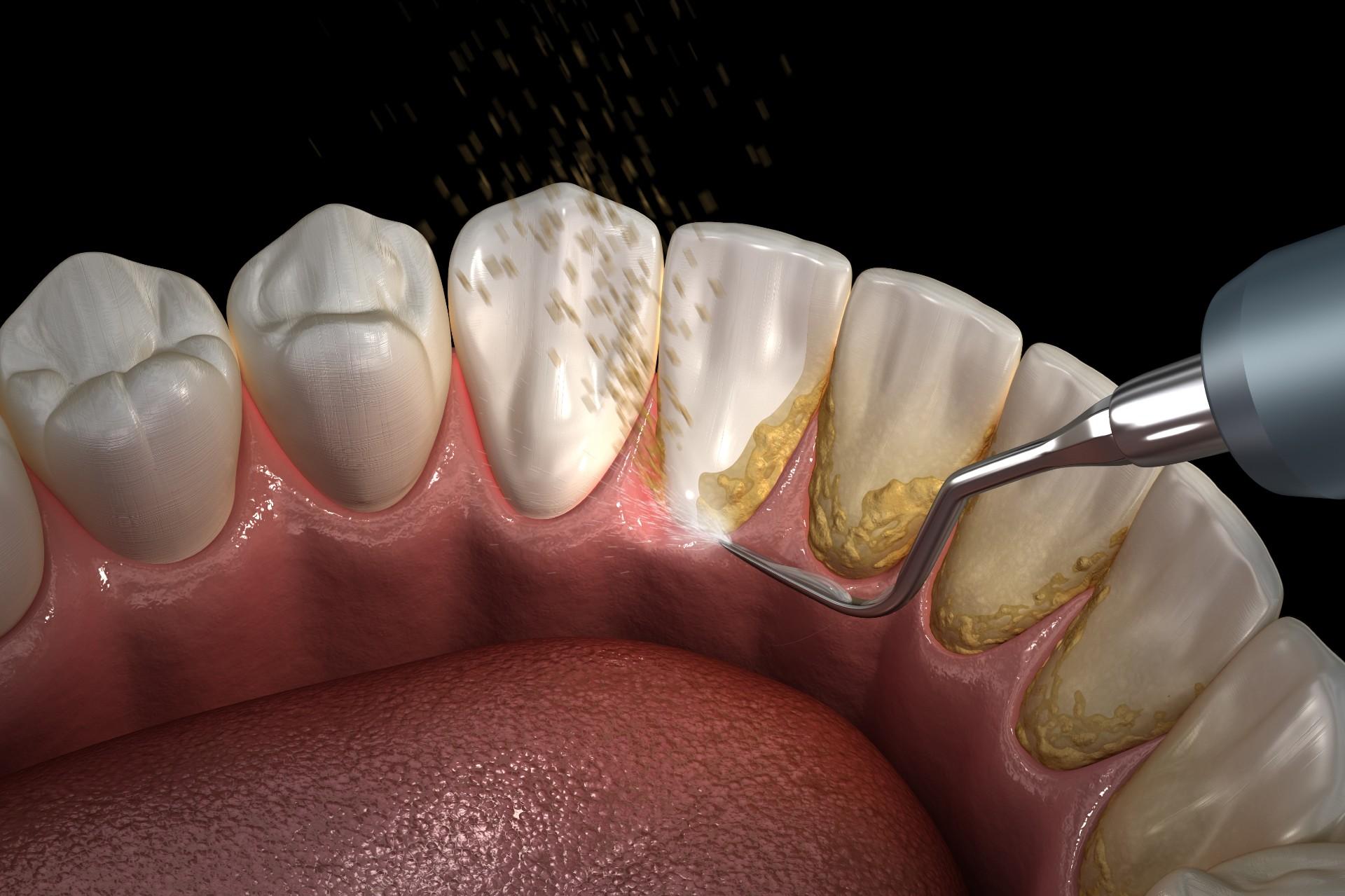 Unveiling the Secret to a Gleaming Smile and Fresh⁣ Breath
