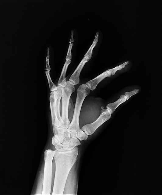 Understanding the Unexpected Diagnosis and Its Impact on Daily Life