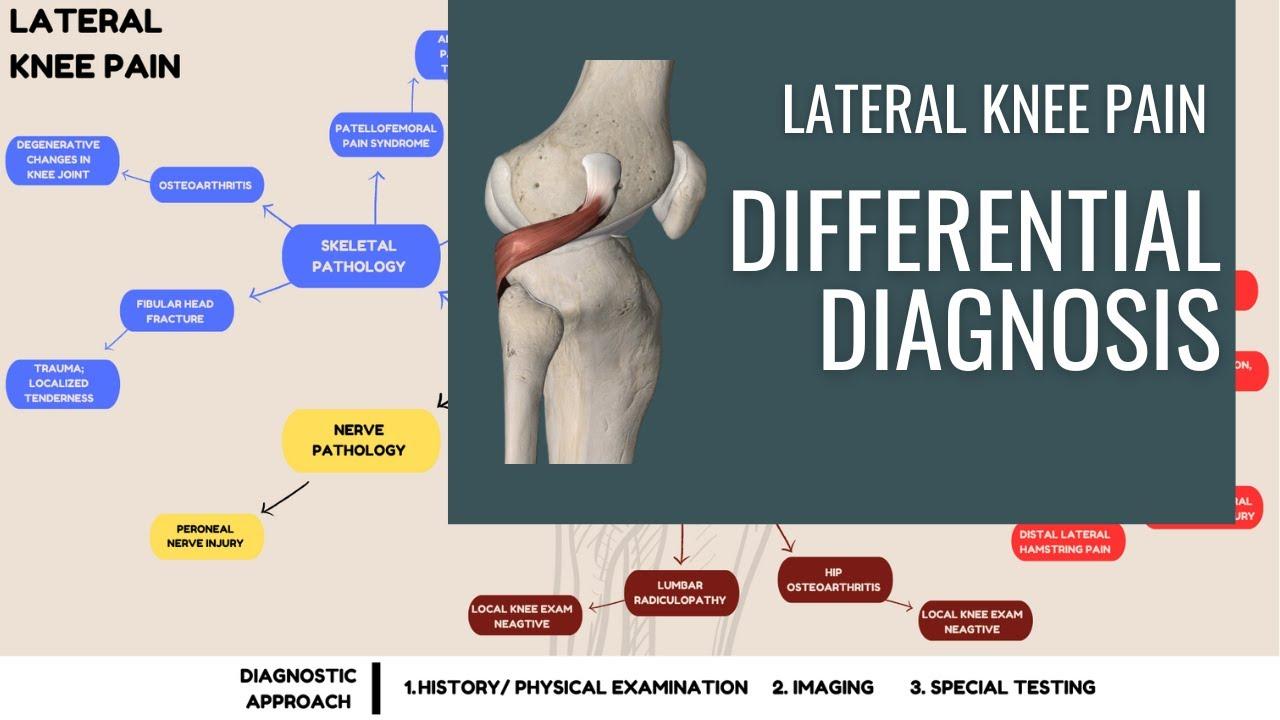 The fallacy ⁤of Self-Diagnosis: Why Trusting Your Knees to a Specialist Matters