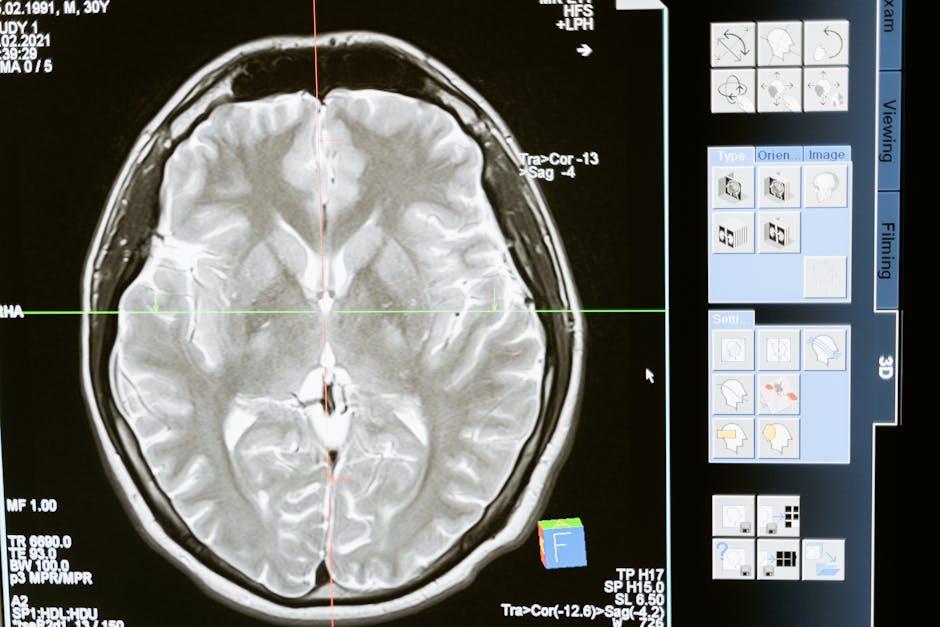 Understanding How Lifestyle Choices Impact Brain Health