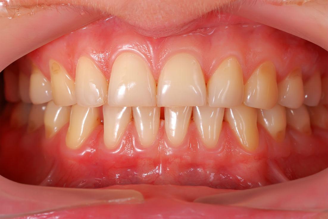 Understanding the ⁤Connection ‍Between Gum Health and Overall‌ Well-Being