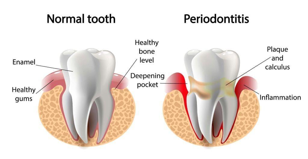When ‌to seek Professional Help for Gum Health Concerns