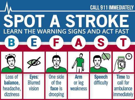 Immediate Action:⁣ What to Do if You ‌Suspect⁤ a Stroke