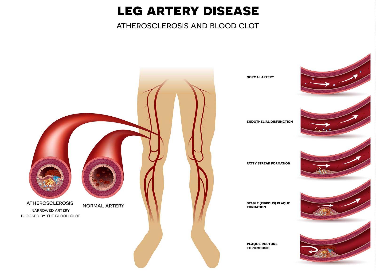 Essential Symptoms ⁢That Signal Vascular Issues